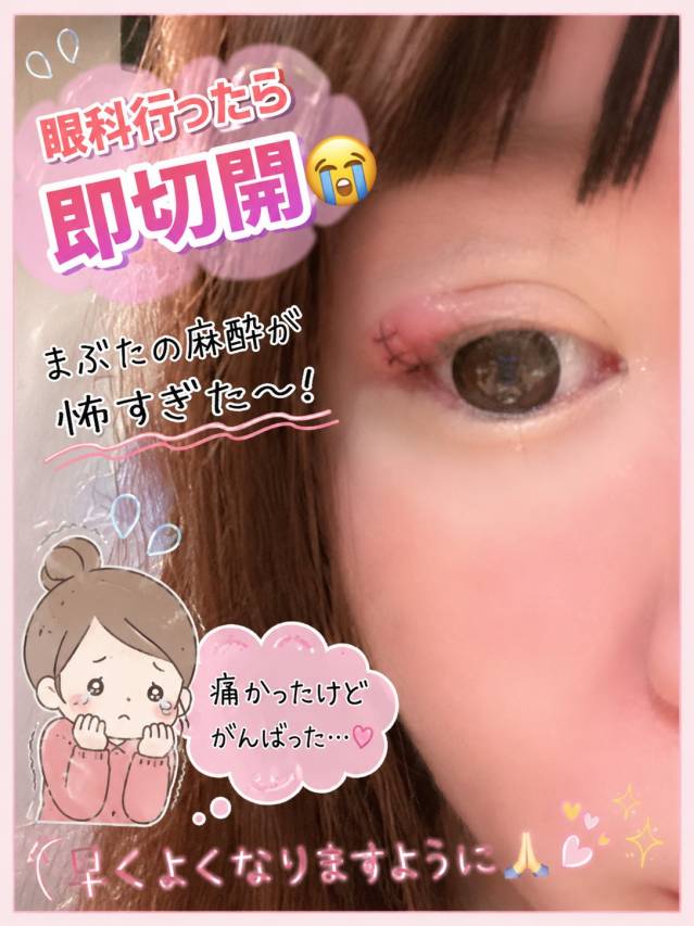 めばちこ奮闘記！